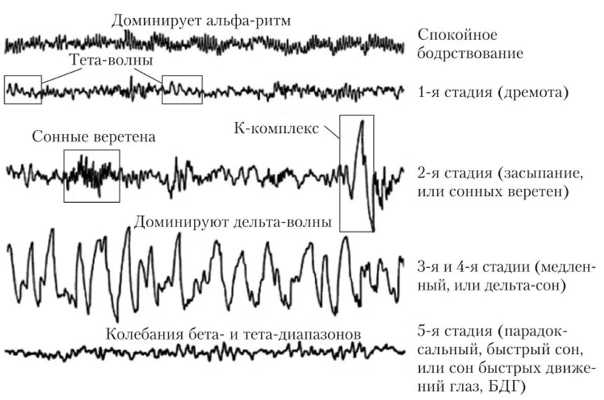 Фаза быстрого сна ЭЭГ. Фазы медленного сна ЭЭГ. ЭЭГ-корреляты фаз сна.. Описание ЭЭГ сна для детей.