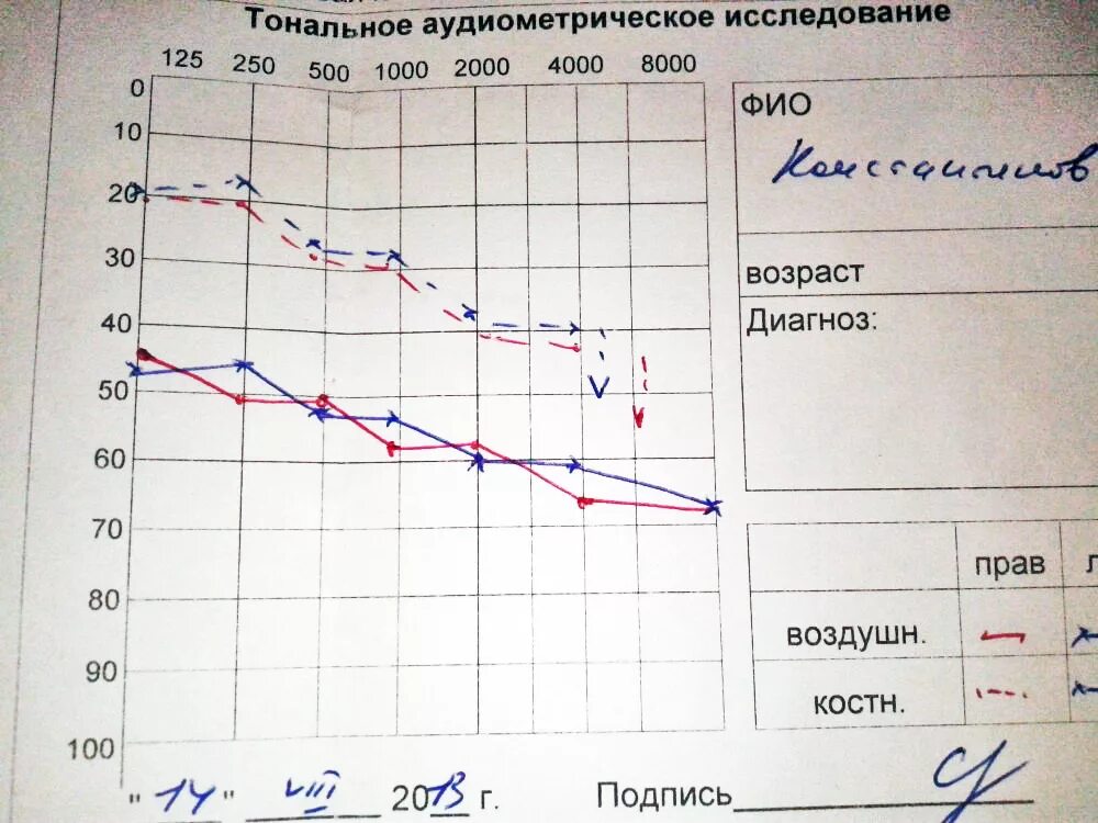 Степени потери слуха. Международная классификация степеней нарушения слуха. Инвалидность по потере слуха. Слуховое восприятие при iv степени потери слуха. Степень глухоты инвалидность.