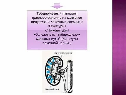 Туберкулезный папиллит