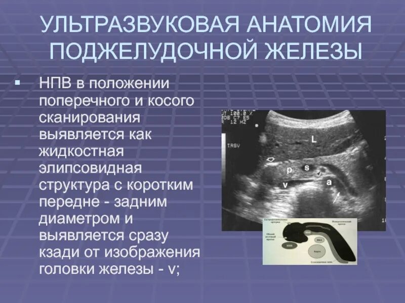 Неоднородные изменения поджелудочной железы. УЗИ поджелудочной железы. УЗИ брюшной полости поджелудочная железа. Ультрасонография поджелудочной железы. Крючковидный отросток поджелудочной железы на УЗИ.