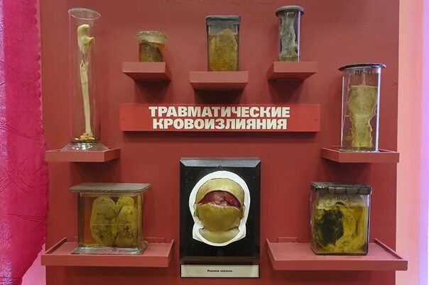 Судебный музей спб. Музей судебной медицины мечникова в санкт-петербурге. анатомический музей мечникова.