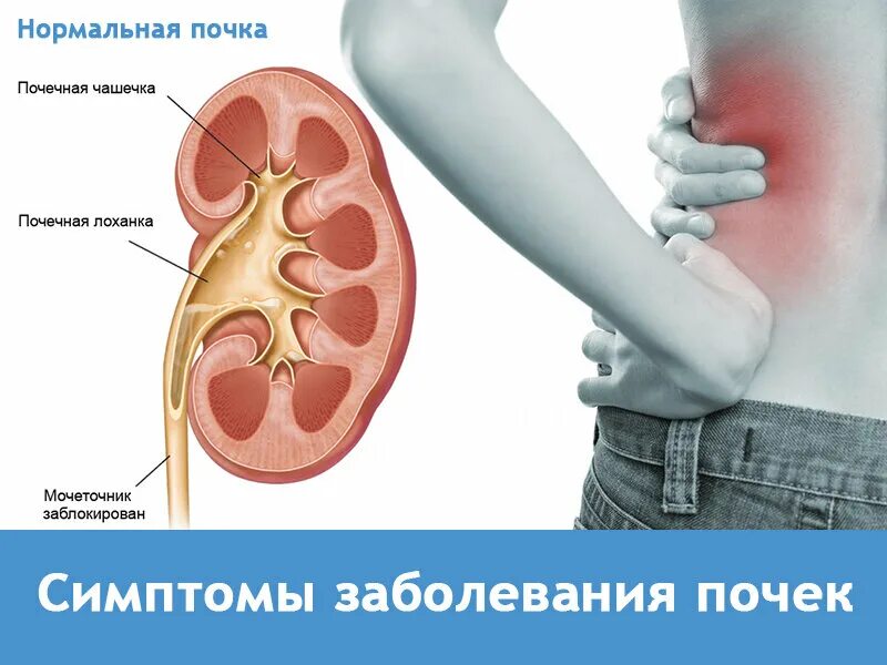 Почему плохие почки