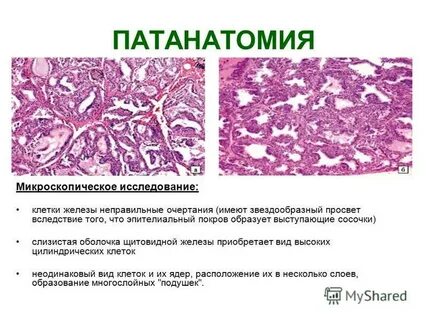 Патанатомия это