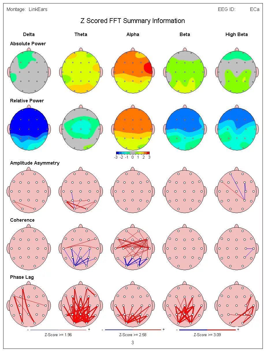 Brain карта. QEEG Brain Map. Brain Mapping. Brain Maps EEG. ЭЭГ головного мозга.