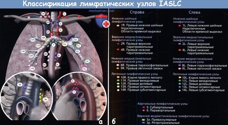 Легочные лимфоузлы. Группы лимфоузлов средостения схема. Лимфатические узлы средостения на кт схема. Лимфатические узлы грудной клетки кт анатомия. Лимфатические узлы средостения на кт.