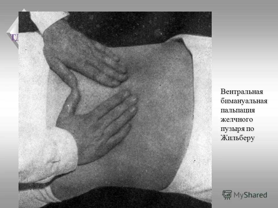 Пальпация желчного пузыря. Хруст при пальпации. Хруст при пальпации. Хрящи гортани и подъязычная кость. Методика пальпации привратника.