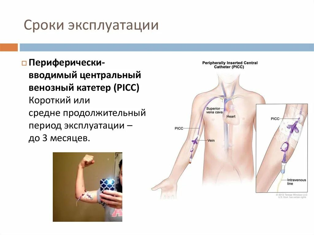 Центральный венозный катетер постановка. Катетеризация центральных вен. Центральный венозный катетер схема. Постановка центрального венозного катетера алгоритм. Осложнения катетеризации вены