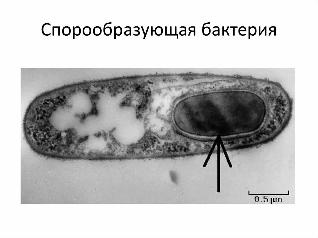 Микроорганизмы образующие споры. Спорообразование у Bacillus. Споры бактерий бацилл. Эндоспоры бактерий. Споруляция бактерий микробиология.