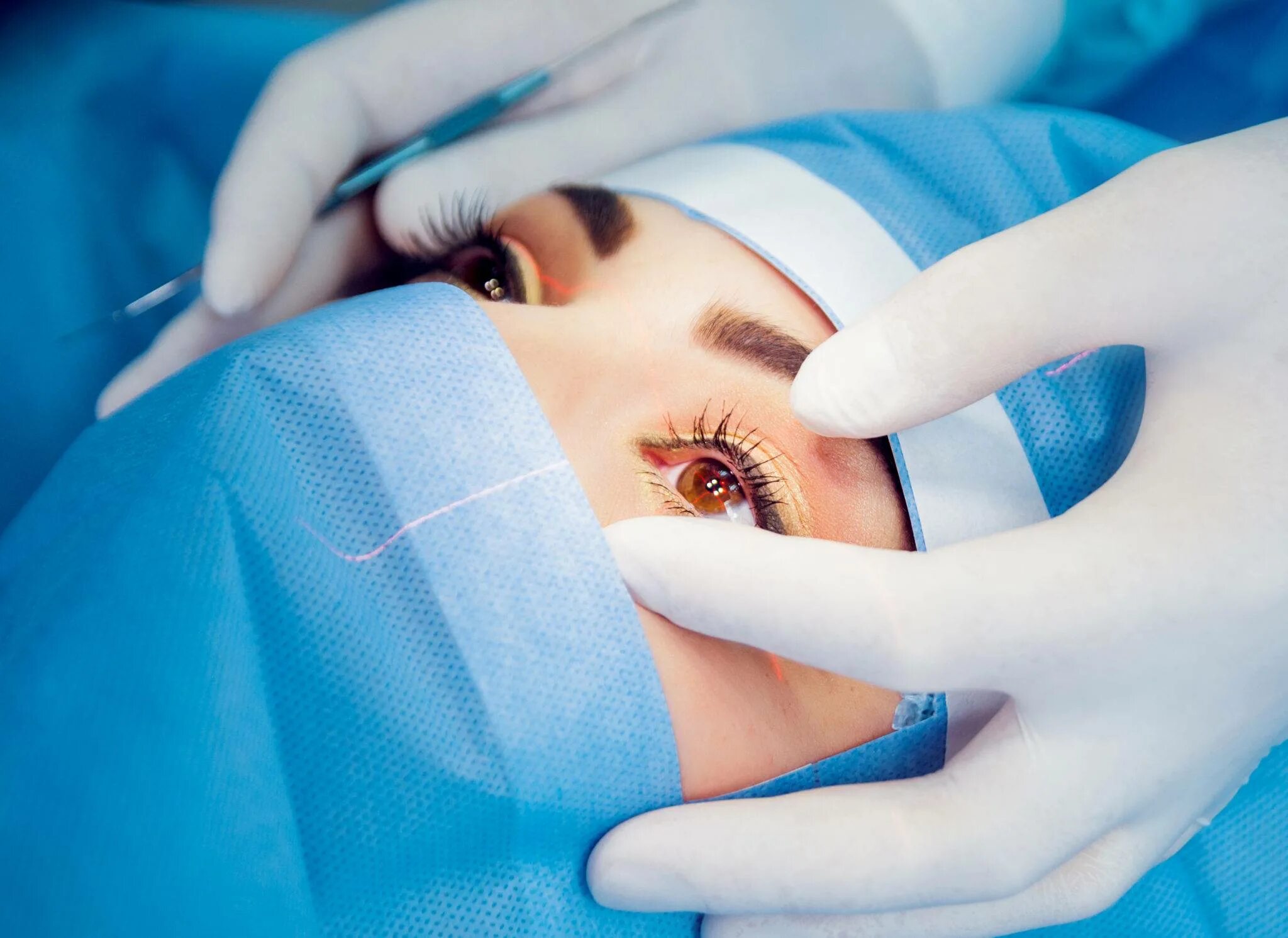 После операции на глаза можно. Лазерная коррекция зрения femto lasik. операция лэйсик на глаза.