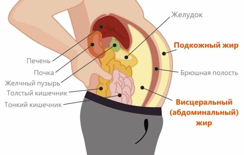 Сколько человек в животе. Висцеральное ожирение брюшной полости. Органы брюшной полости человека ожирение. Висцеральный жир внутренних органов. Подкожный жир и висцеральный жир.