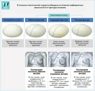Размеры круглых имплантов