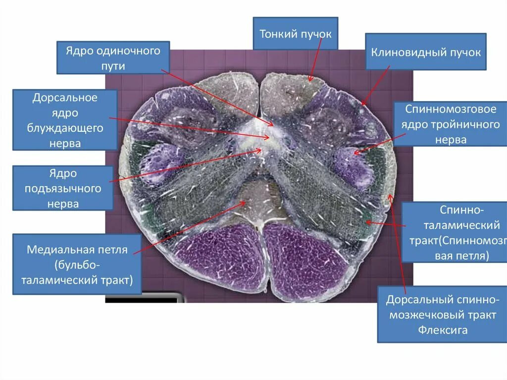 Стационарное ядро. Ядро одиночного пути. Тонкий и клиновидный пучки. Дорсальное ядро блуждающего нерва. Ядро одиночного пути путь.
