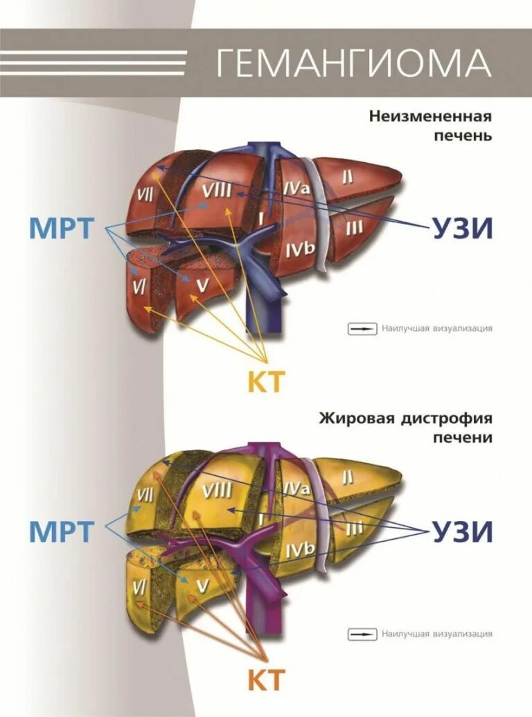 Причины увеличения доли печени