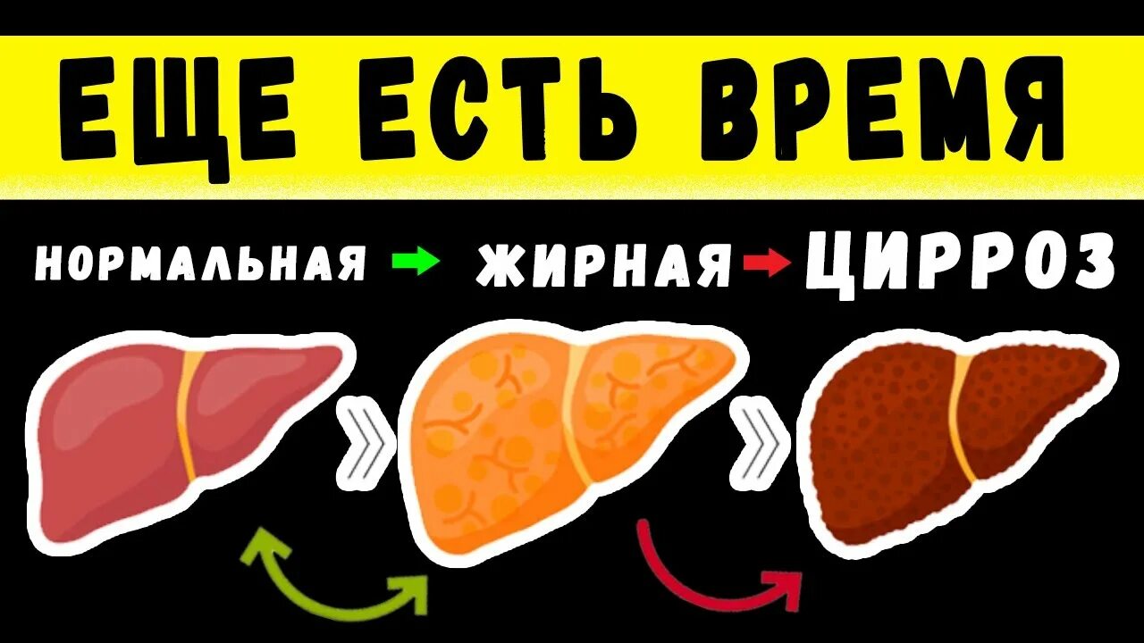 Убрать жировую печень. Признаки жирной печени.