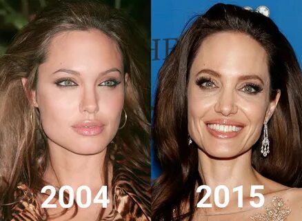 Jolie отзывы