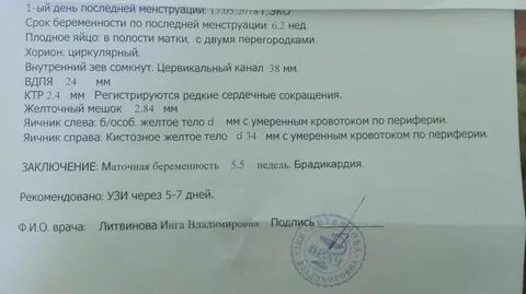 Узи 5 недель норма