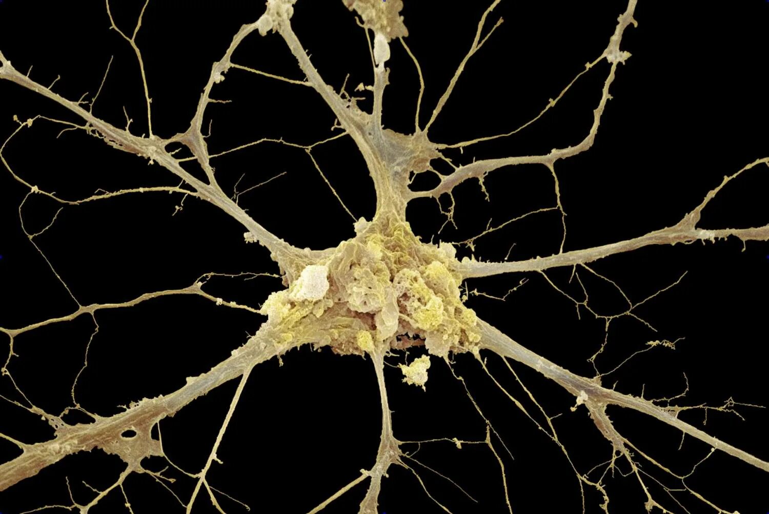 Нервная ткань Нейрон. Аксон нейрона микрофотография. Нейрон Пуанкаре микрофотография. Нейрон клетка головного мозга.