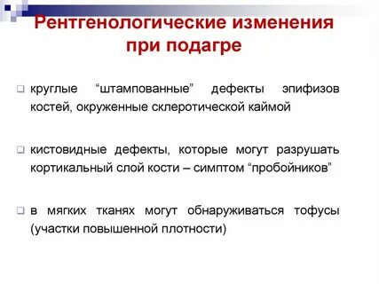 Рентгенологические признаки подагры