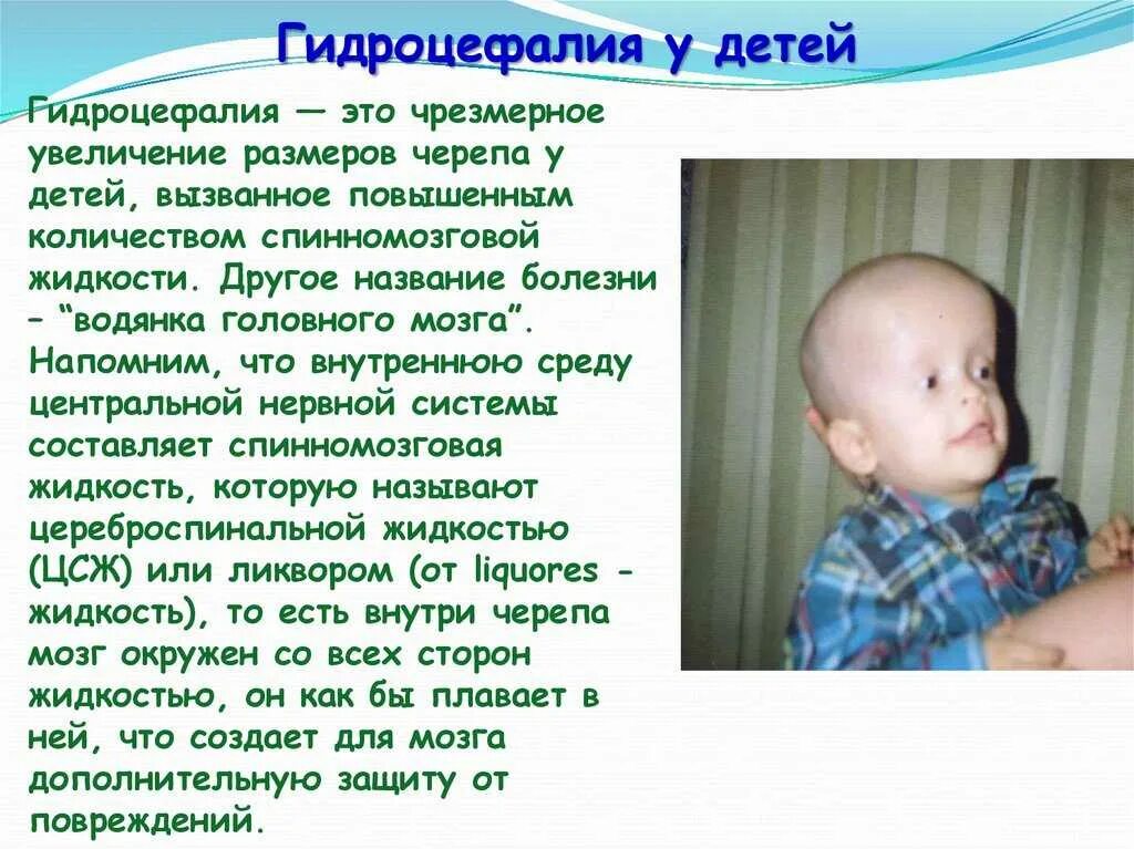 Опасна водянка головного мозга. Гидроцефалия желудочков головного мозга. Шунт головной мозг ликвора. Обструктивная гидроцефалия. Декомпенсированная гидроцефалия.