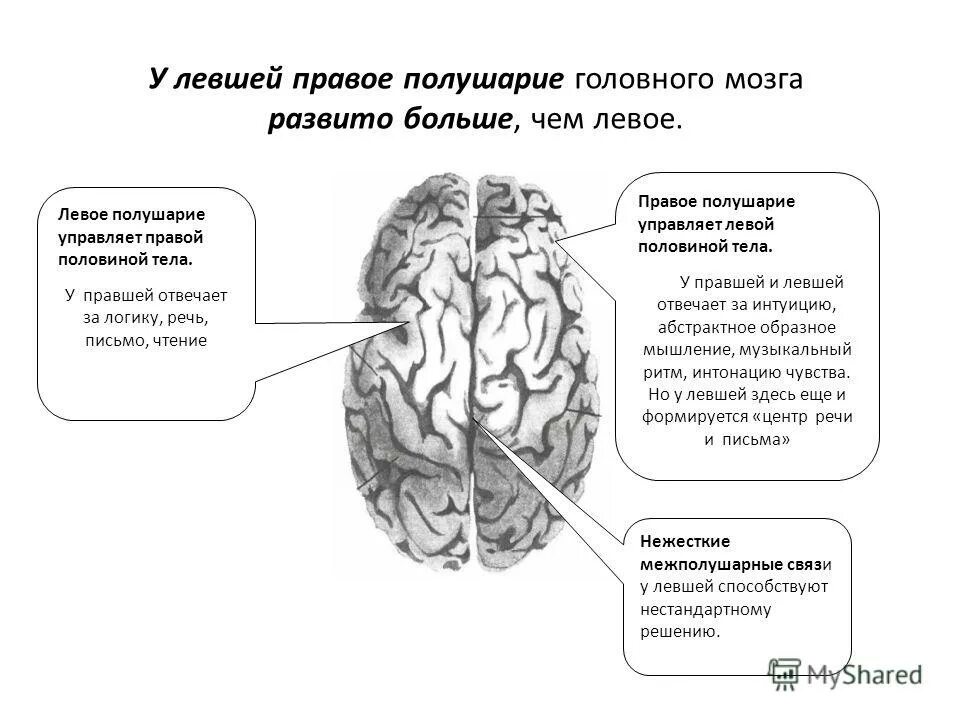 Человек который и правой и левой. Левша особенности правое полушарие. Правое и левое полушарие Левша правша. Какое полушарие развито у левши. Левша и правша полушария мозга.