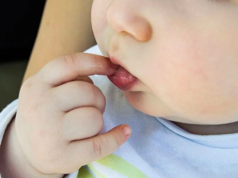 Ребенок с пальцем во рту. Ребенок с рукой во рту. Патологические привычки у детей дошкольного возраста. Почему ребенок берет пальцы. Почему ребенок берет пальцы.