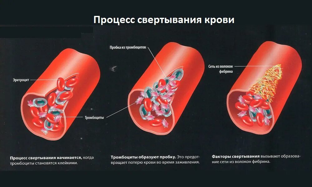 Почему при анализе свернулась кровь. Компонент свертывающей системы плазмы крови. Тромбоциты процесс свертывания крови. Тромбоциты схема свертывания крови. Тромбоциты в крови фаза свертывание.