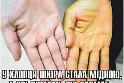 Желтеют руки причины