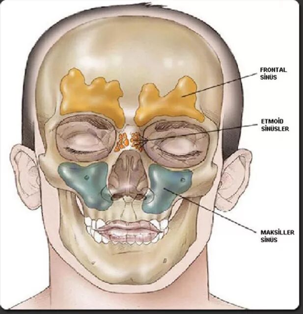 Боли костей лица. Фронтит и фронтальный синусит. Гайморовы и лобные пазухи. Фронтит (фронтальный синусит) симптомы. Гайморова пазуха верхней челюсти.