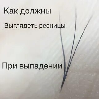 Сколько в норме выпадает ресниц в день