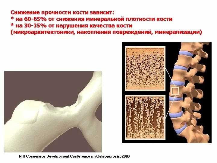 Как укрепить костную ткань