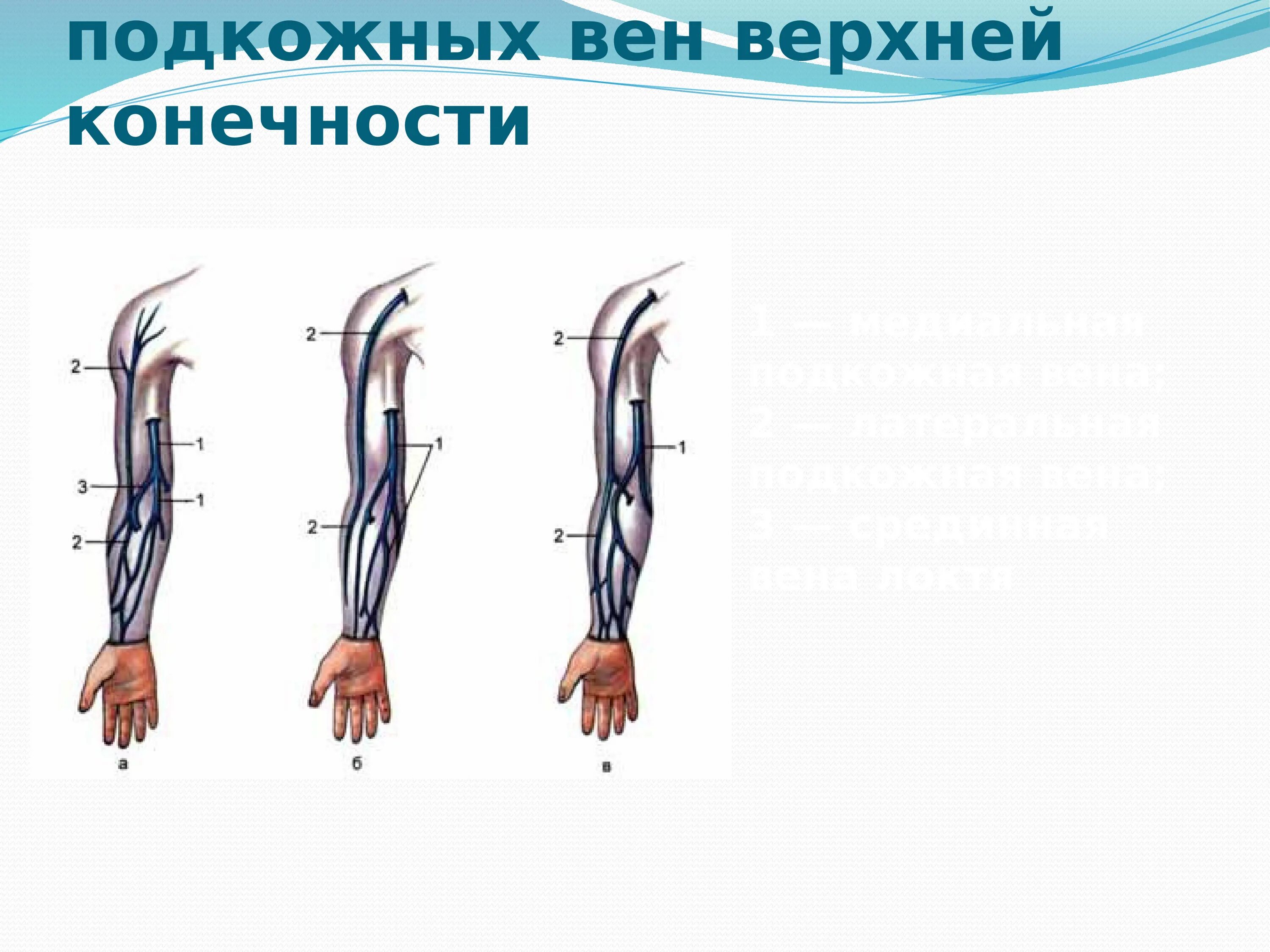 Вены верхней конечности. Варианты расположения подкожных вен верхней конечности. Головная Вена верхней конечности. Анатомия вен верхней конечности. Подкожные вены верхней конечности.