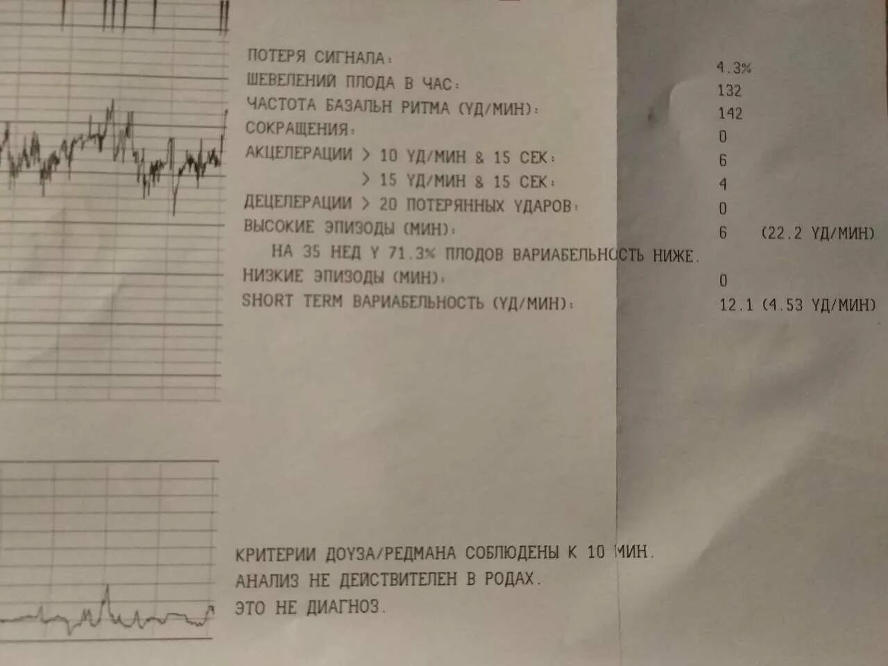 Норма шевелений плода на КТГ. КТГ шевеления плода в час норма. КТГ при беременности шевеления плода норма. Шевеления плода на КТГ. 38 неделя активно шевелится