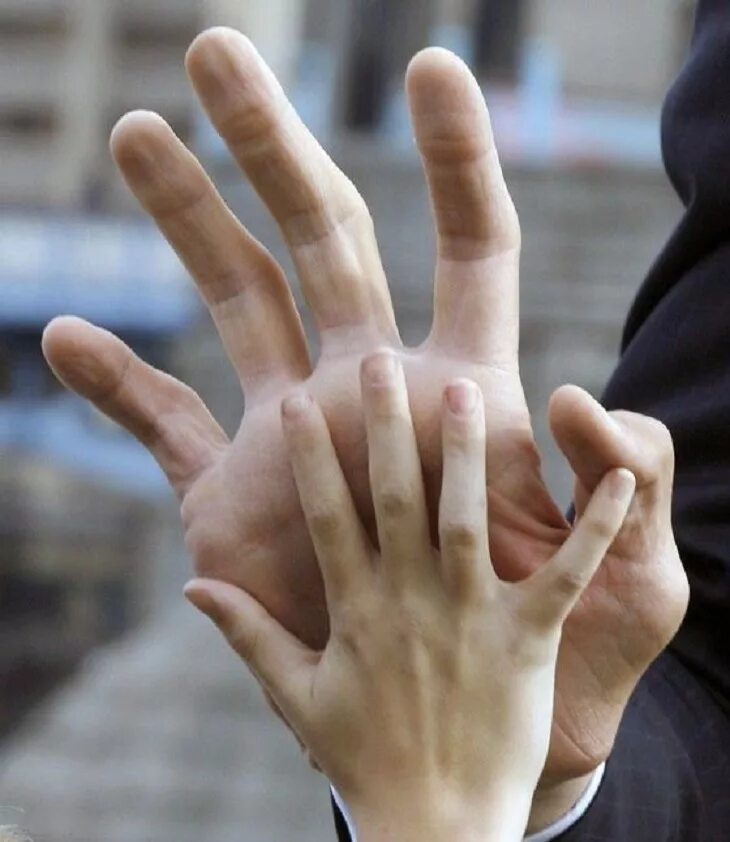 Большие руки джефф дейб. Джефф дейб армрестлинг. Брахидактилия мизинцев. Маленькая ладонь. Одна ладонь больше другой.