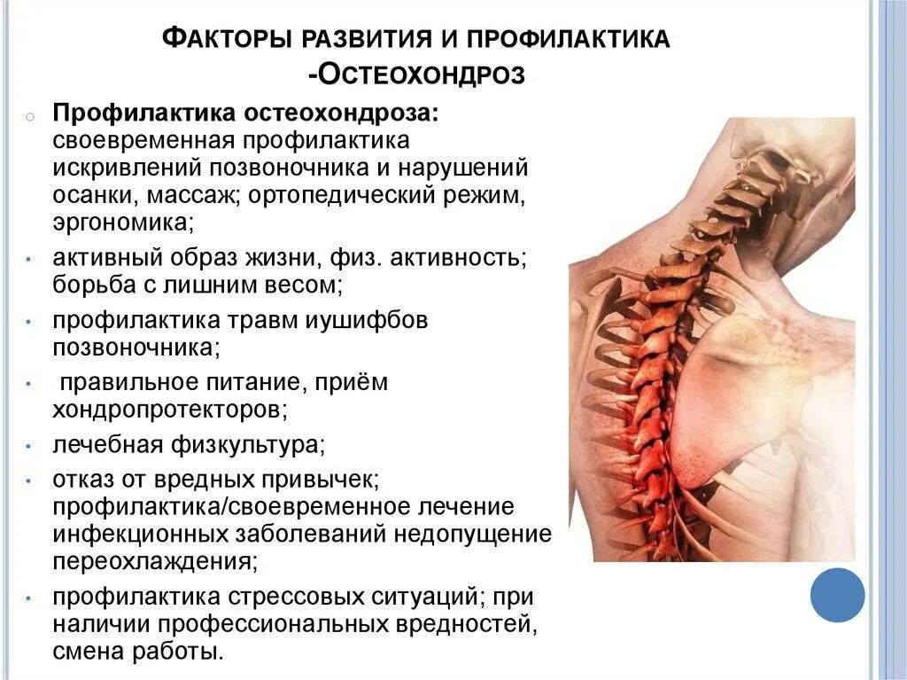 Остеохондроз локальный статус. Остеохондроз. Профилактика остеохондроза. Памятка остеохондроз. Шейный отдел позвоночника профилактика.