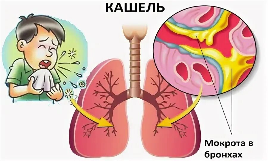 How To Clear Post Nasal Drip Sale inos.kz