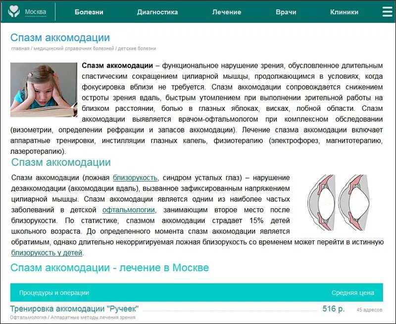 Спазм аккомодации у взрослых. Спазм аккомодации. Терапия спазма аккомодации. Спазм аккомодации клиника. Классификация спазма аккомодации.