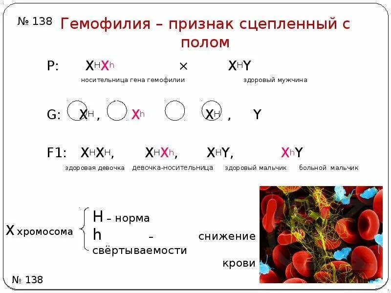 Гемофилия это признак сцепленный с