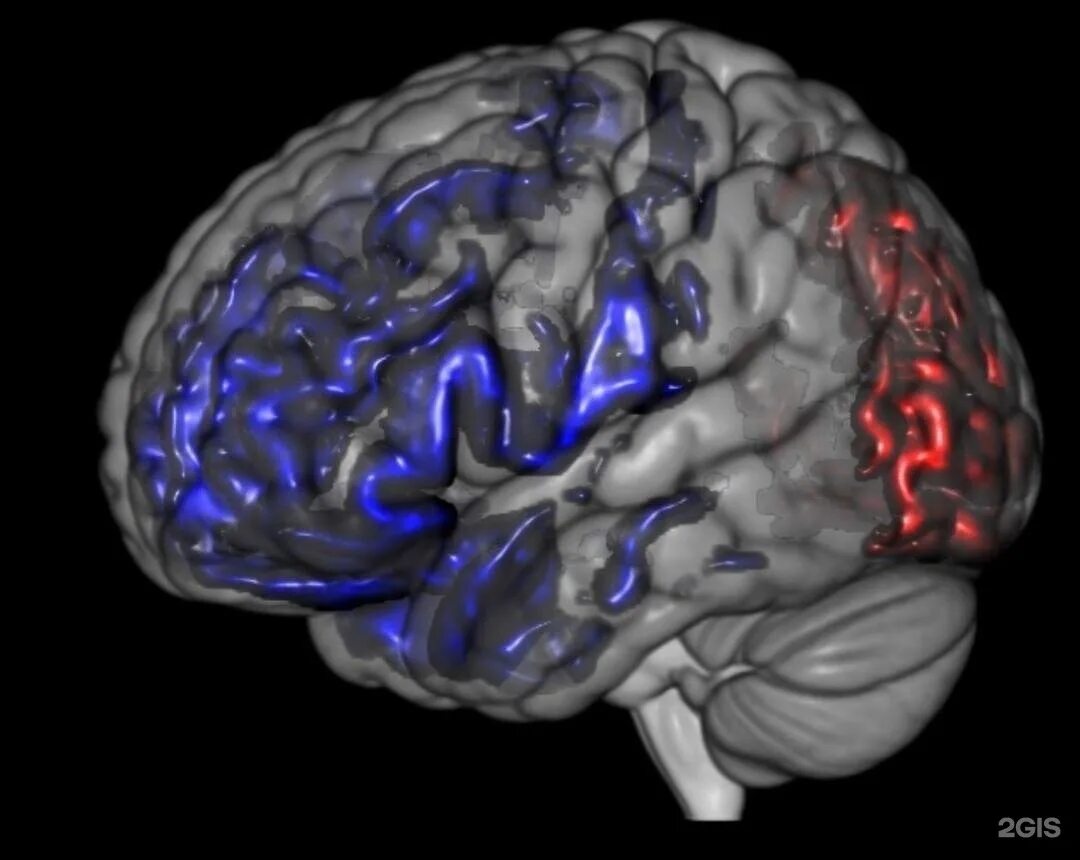 Медицинский центр мозга. Тренажер мозга деменция. Исследований головной мозг жи 93. Жи исследований головного мозга после 39.