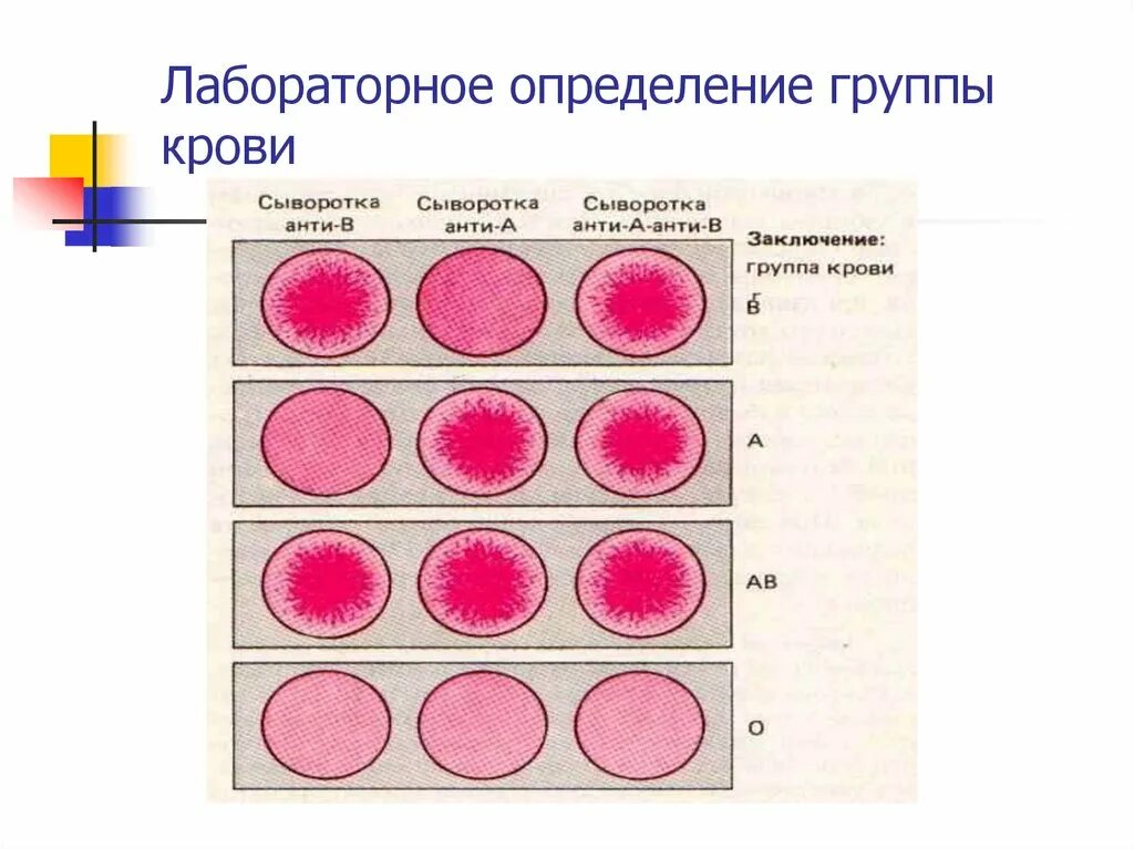 Сывороточный метод определения группы крови. Лабораторные способы определения групп крови. Стандартные изогемагглютинирующие сыворотки для определения группы. Сыворотка 4 группы крови.