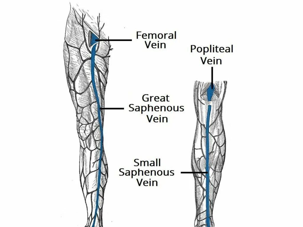 Вена сафена Магна анатомия. Вены нижней конечности анатомия варикоз. Подкожная Вена бедра анатомия.