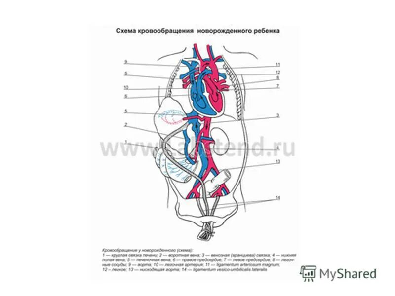 Кровообращения передней. Кровообращение плода схема. Кровообращение новорожденного схема. Схема кровоснабжение ребенка. Система кровообращения у новорожденных схема.