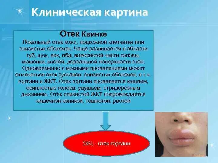 Методички 1) ЭКГ 2) Схема