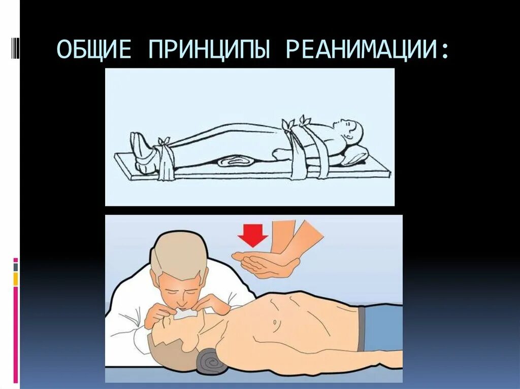 Манипуляции в реанимации. Понятие о реанимации. принципы реанимации. общие принципы реанимации. реанимация понятие основные принципы.