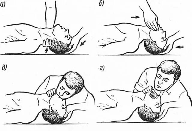 выполнение искусственного дыхания детей. ивл новорожденному желательно. при искусственной вентиляции легких необходимо. сипап аппарат для новорожденных недоношенных детей. ивл новорожденному желательно проводить.