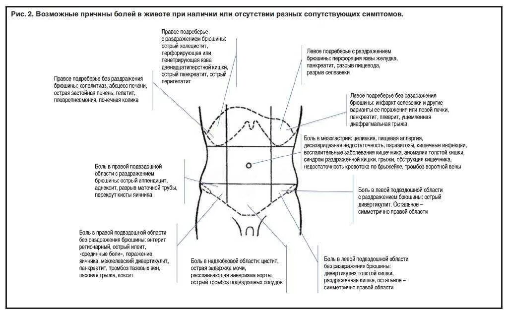 Боль справа у женщин. Тянущая боль в правом низу живота. Левая подвздошная область живота. Схема болей в животе у мужчины. Подвздошная область живота справа.