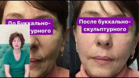 Лицо альтернатива