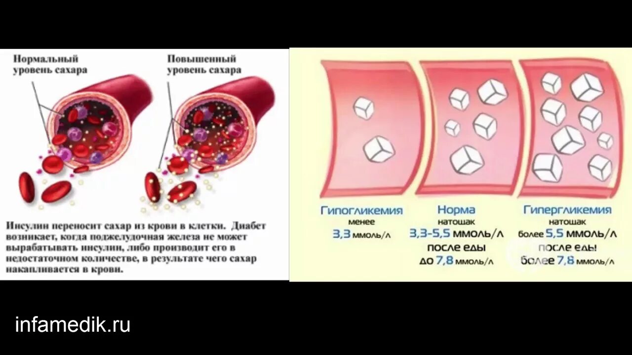 Сахар в крови. Уровень сахара в крови. Повышение сахара в крови. Диабет сахар в крови. Сахар в крови снижается после