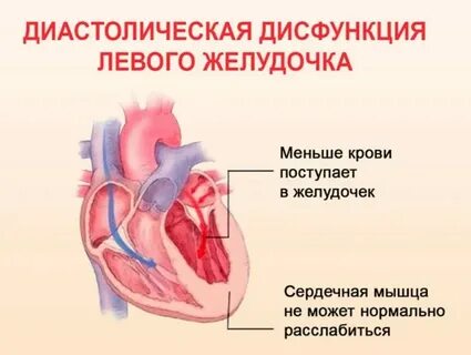 Почему сердце левее