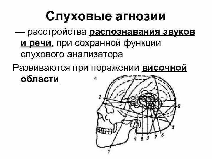 Слуховая и акустическая агнозия. Слуховая агнозия при поражении. Речевая агнозия у детей. Симптомы речевой слуховой агнозии. Речевая агнозия у детей.