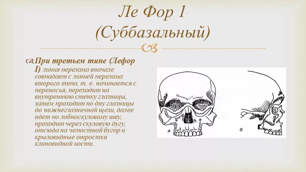 Переломы Лефорт верхней челюсти. Переломы верхней челюсти по Лефор 1. Суббазальный перелом верхней челюсти. Классификация переломов верхней челюсти по Лефор.